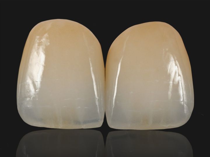 Two e.max central crowns with a reflection below