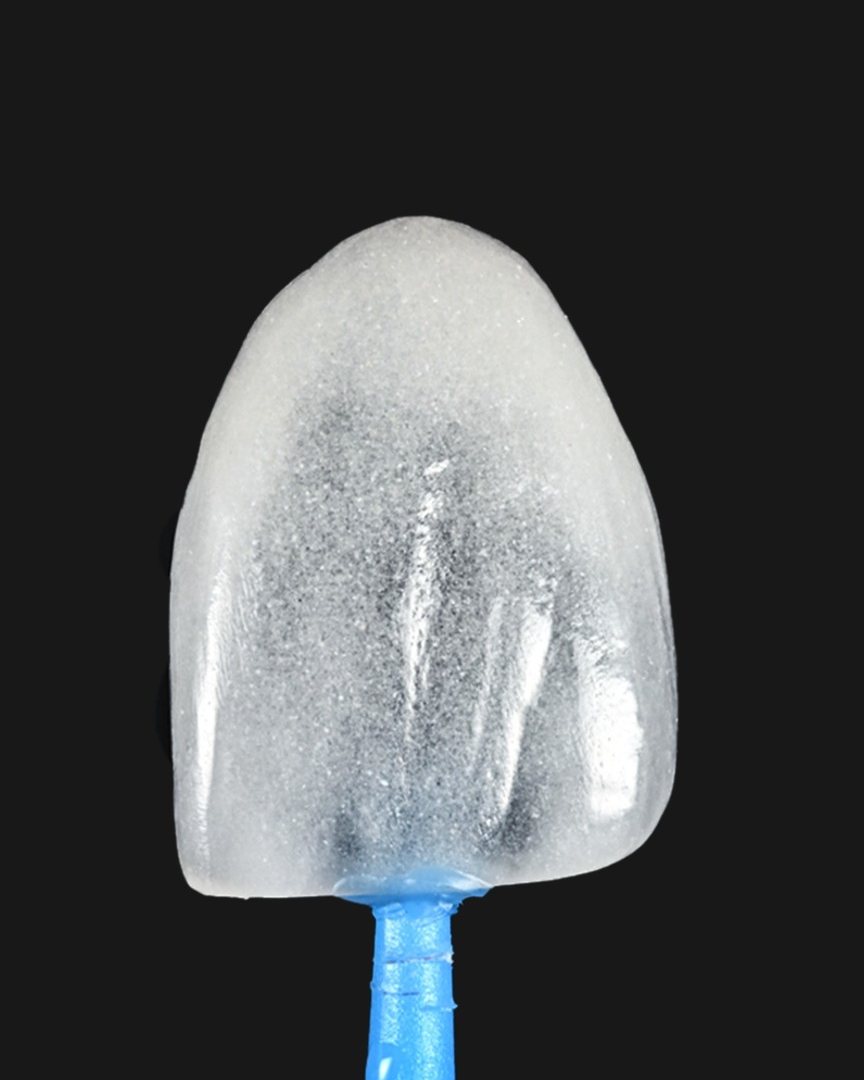 A single feldspathic veneer held on a blue microbrush